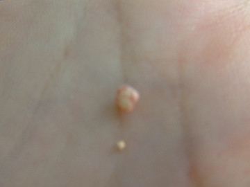 20060813_540_thumb.jpg