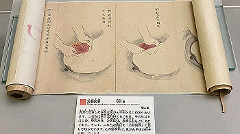 20201108_030903983_ios_thumb.jpg